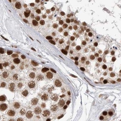 NIPP1 Antibody - BSA Free Immunohistochemistry-Paraffin: NIPP1 Antibody [NBP1-90112]