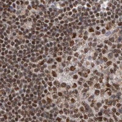 NIPP1 Antibody - BSA Free Immunohistochemistry-Paraffin: NIPP1 Antibody [NBP1-90112]