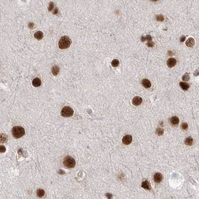 NIPP1 Antibody - BSA Free Immunohistochemistry-Paraffin: NIPP1 Antibody [NBP1-90112]
