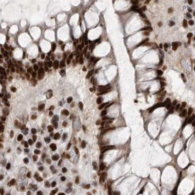 NIPP1 Antibody - BSA Free Immunohistochemistry-Paraffin: NIPP1 Antibody [NBP1-90112]