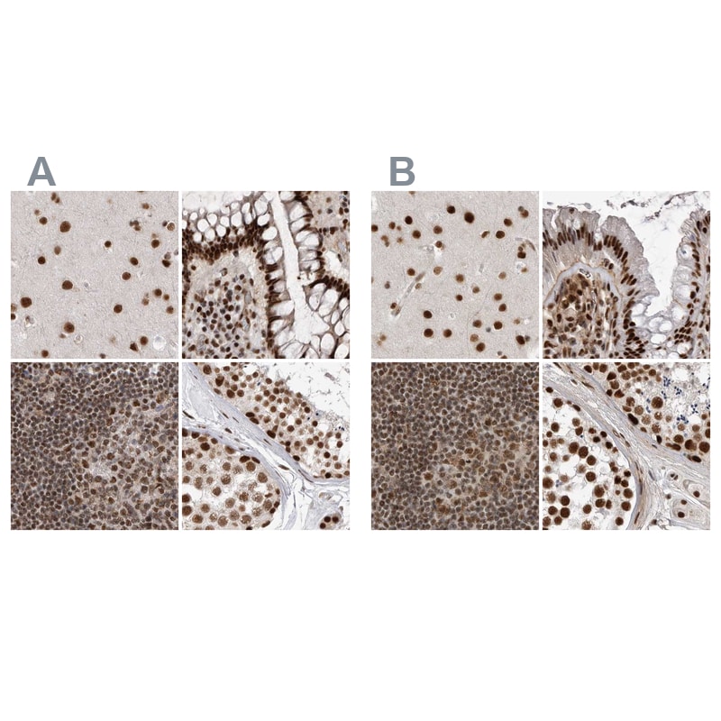 NIPP1 Antibody - BSA Free Immunohistochemistry-Paraffin: NIPP1 Antibody [NBP1-90112]