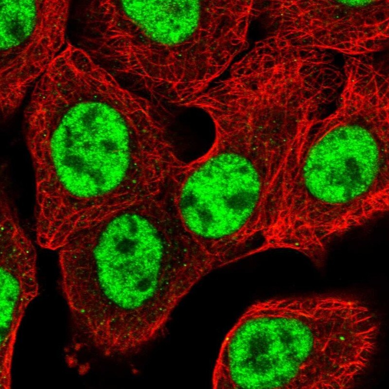NIPP1 Antibody - BSA Free Immunocytochemistry/ Immunofluorescence: NIPP1 Antibody - BSA Free [NBP1-90112]