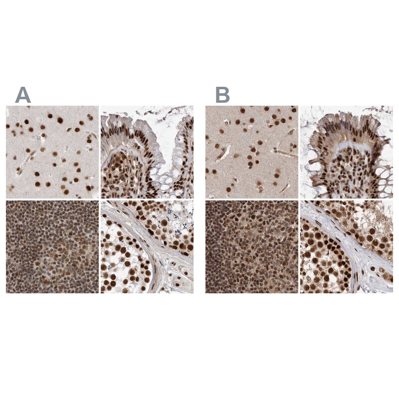 NIPP1 Antibody - BSA Free Immunohistochemistry: NIPP1 Antibody - BSA Free [NBP1-90113]