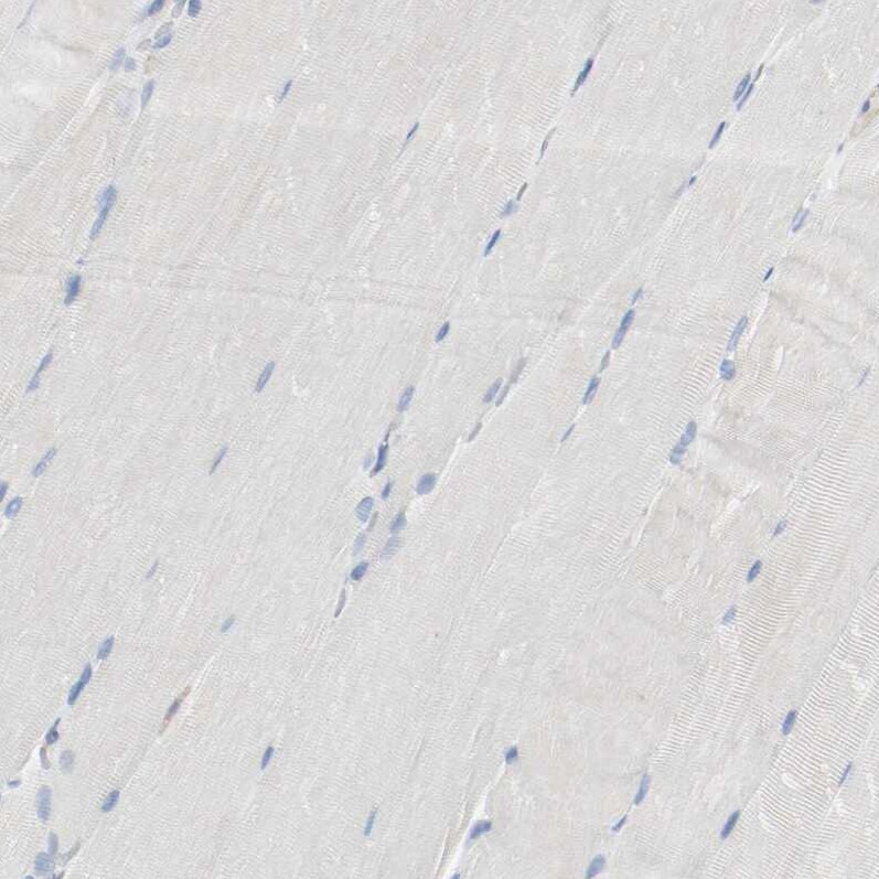 actin-related protein 2/3 complex subunit 1B Antibody - BSA Free Immunohistochemistry: actin-related protein 2/3 complex subunit 1B Antibody - BSA Free [NBP1-90114]