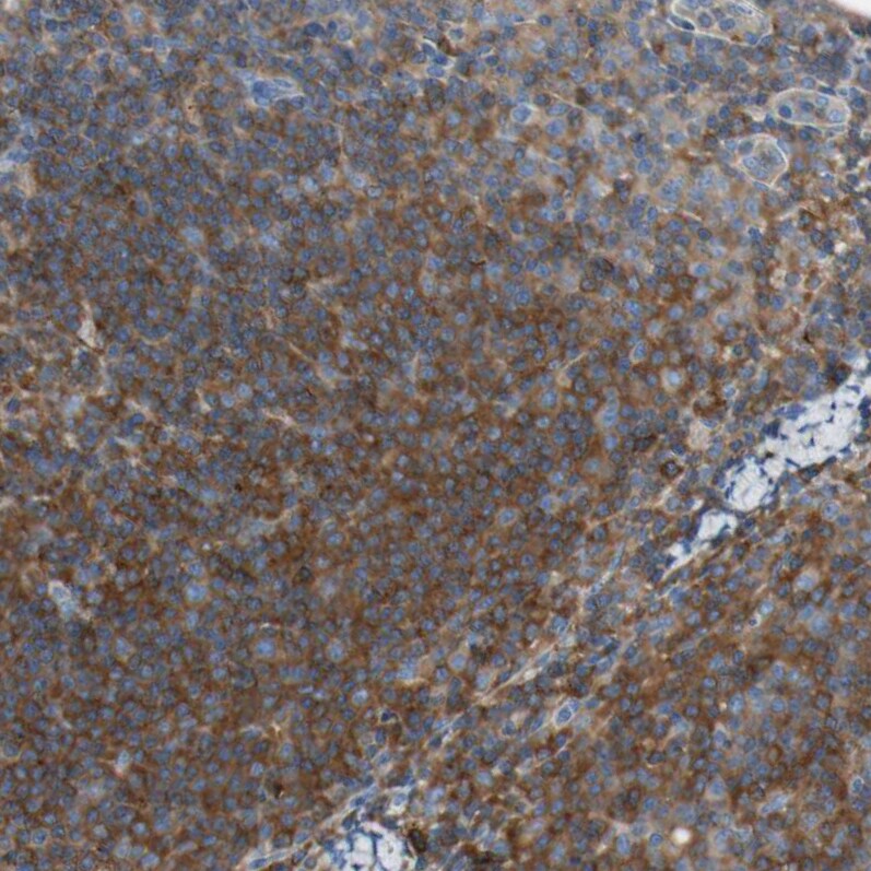 actin-related protein 2/3 complex subunit 1B Antibody - BSA Free Immunohistochemistry: actin-related protein 2/3 complex subunit 1B Antibody - BSA Free [NBP1-90114]