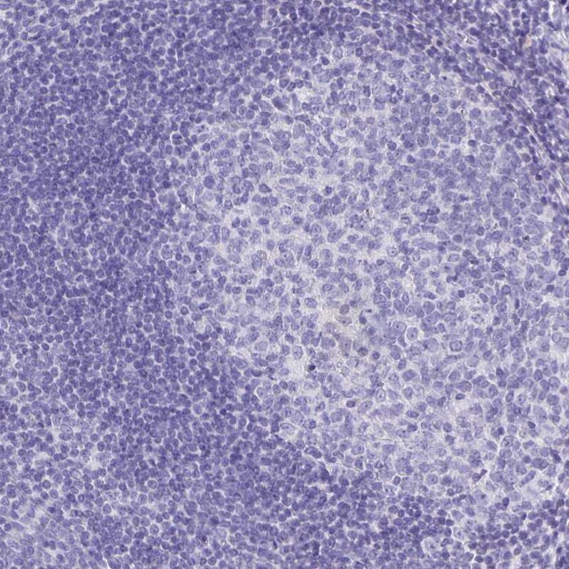 Aquaporin-6 Antibody - BSA Free Immunohistochemistry: Aquaporin-6 Antibody - BSA Free [NBP1-90119]