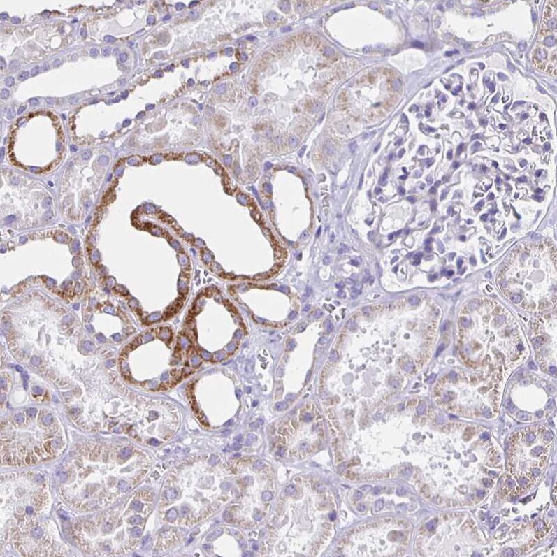 Aquaporin-6 Antibody - BSA Free Immunohistochemistry: Aquaporin-6 Antibody - BSA Free [NBP1-90119]
