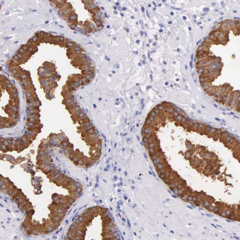Kallikrein 3/PSA Antibody - BSA Free Immunohistochemistry: Kallikrein 3/PSA Antibody - BSA Free [NBP1-90120]
