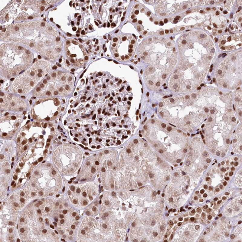 APRIN Antibody - BSA Free Immunohistochemistry-Paraffin: APRIN Antibody [NBP1-90121]