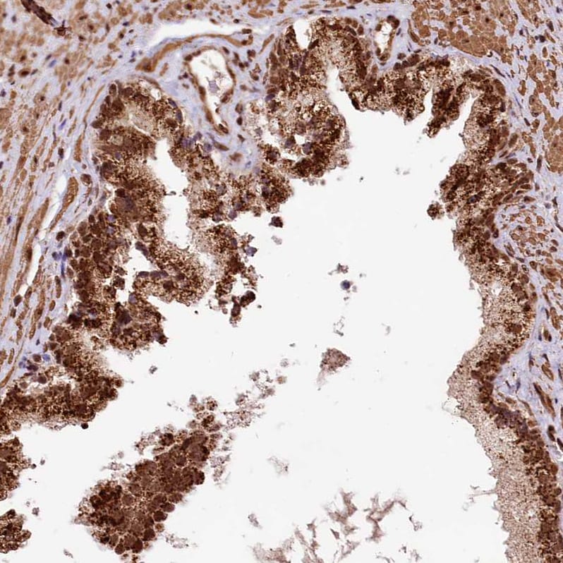 APRIN Antibody - BSA Free Immunohistochemistry: APRIN Antibody - BSA Free [NBP1-90122]