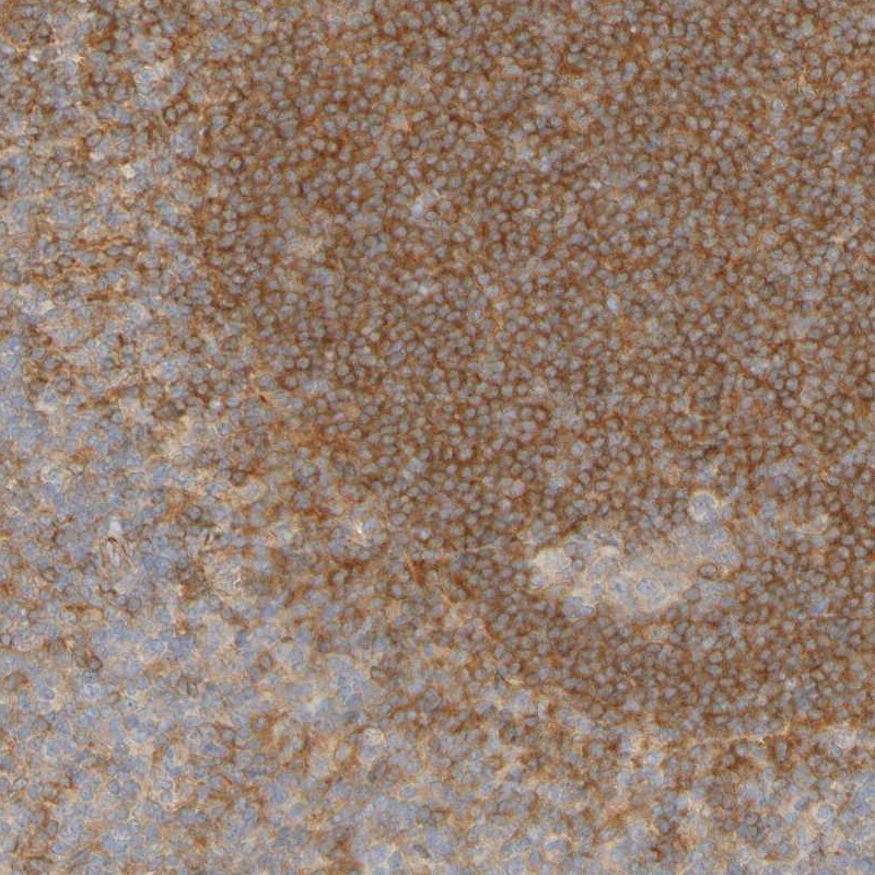 APPL Antibody - BSA Free Immunohistochemistry: APPL Antibody - BSA Free [NBP1-90123]