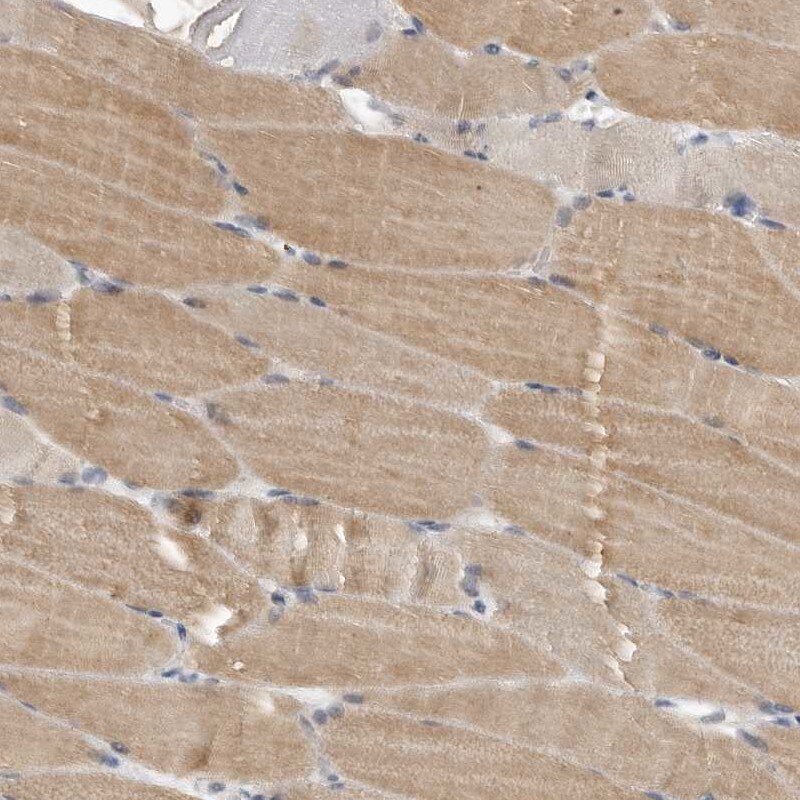 APPD Antibody - BSA Free Immunohistochemistry-Paraffin: APPD Antibody [NBP1-90124]
