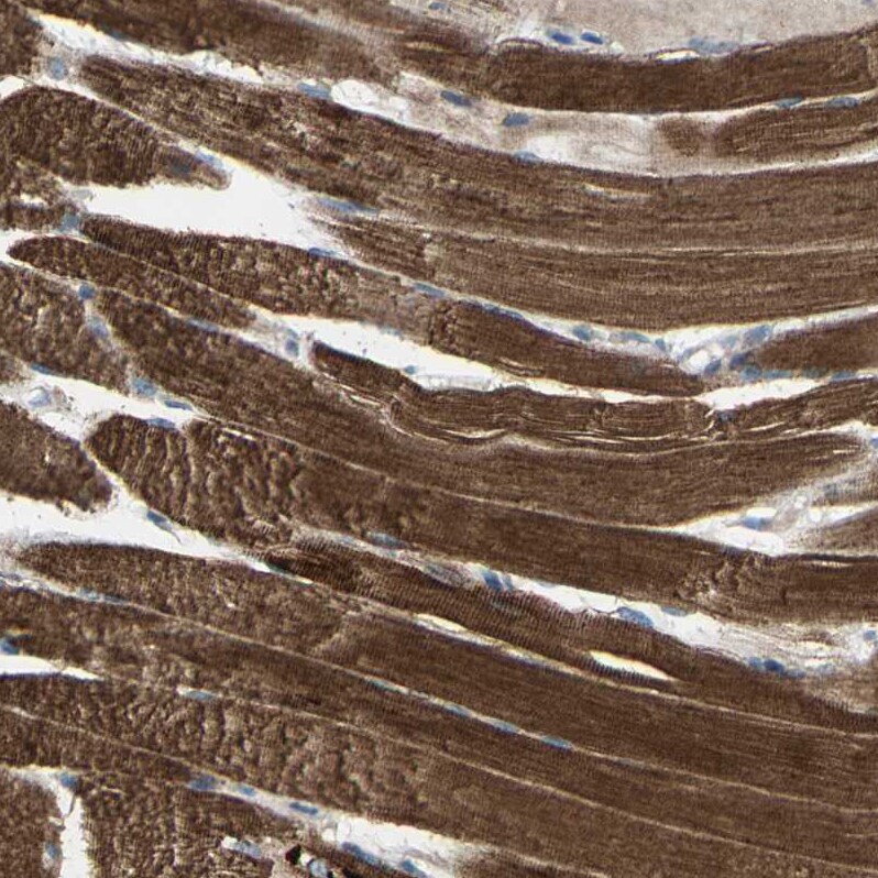 mtRNA polymerase Antibody - BSA Free Immunohistochemistry: mtRNA polymerase Antibody - BSA Free [NBP1-90126]