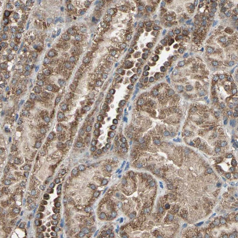 mtRNA polymerase Antibody - BSA Free Immunohistochemistry: mtRNA polymerase Antibody - BSA Free [NBP1-90126]