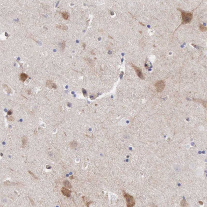 Apolipoprotein L2 Antibody - BSA Free Immunohistochemistry: Apolipoprotein L2 Antibody - BSA Free [NBP1-90127]