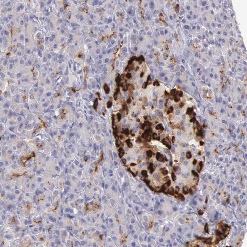 Clusterin/APOJ Antibody - BSA Free Immunohistochemistry: Clusterin/APOJ Antibody - BSA Free [NBP1-90128]