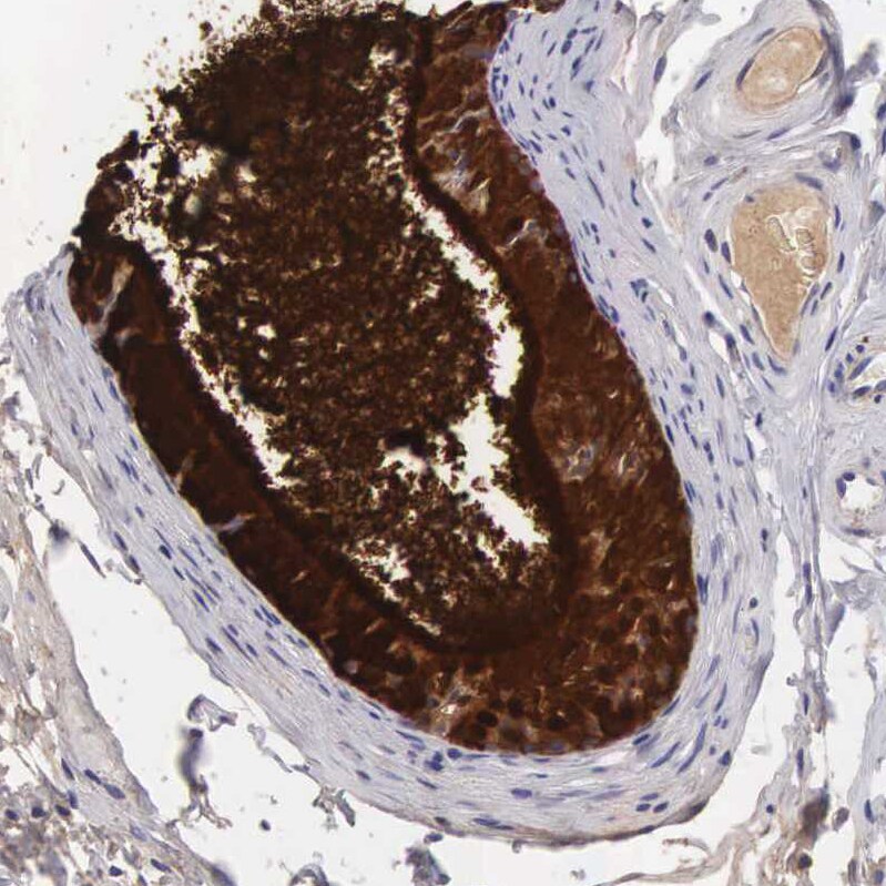 Clusterin/APOJ Antibody - BSA Free Immunohistochemistry: Clusterin/APOJ Antibody - BSA Free [NBP1-90128]