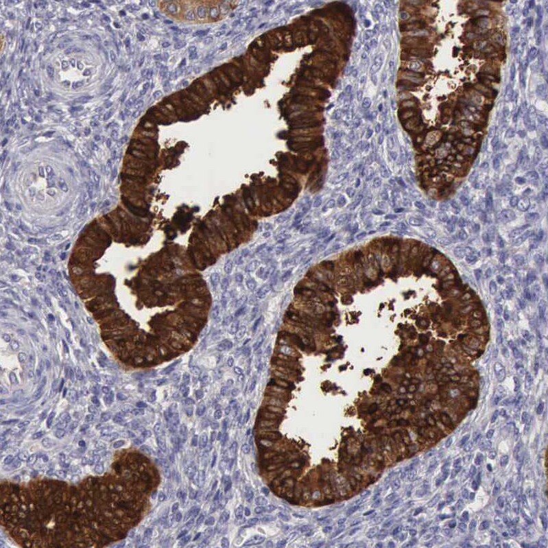 Clusterin/APOJ Antibody - BSA Free Immunohistochemistry: Clusterin/APOJ Antibody - BSA Free [NBP1-90128]