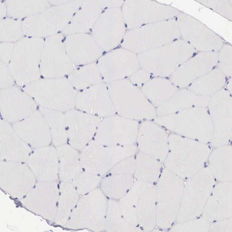 Clusterin/APOJ Antibody - BSA Free Immunohistochemistry: Clusterin/APOJ Antibody - BSA Free [NBP1-90128]
