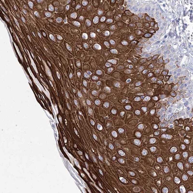 Girdin Antibody - BSA Free Immunohistochemistry: Girdin Antibody - BSA Free [NBP1-90135]