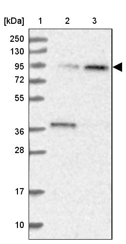 Apc5 Antibody - BSA Free Western Blot: Apc5 Antibody - BSA Free [NBP1-90136]