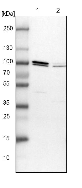 Apc5 Antibody - BSA Free Western Blot: Apc5 Antibody - BSA Free [NBP1-90136]