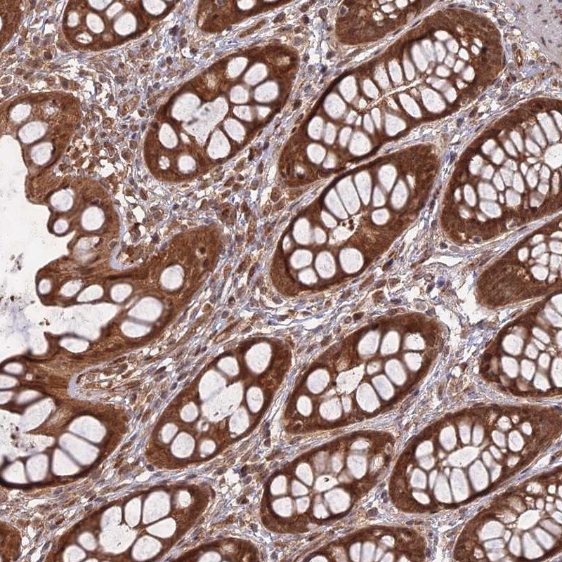Apc4 Antibody - BSA Free Immunohistochemistry: Apc4 Antibody - BSA Free [NBP1-90138]