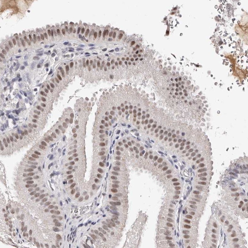 Apc11 Antibody - BSA Free Immunohistochemistry-Paraffin: Apc11 Antibody [NBP1-90139]