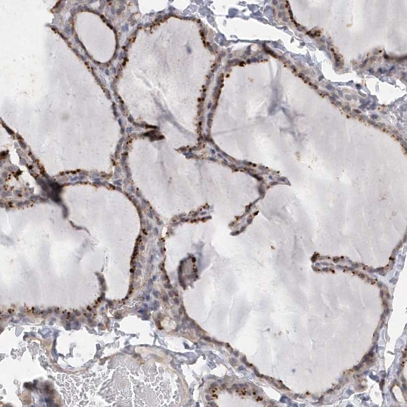 Apc1 Antibody - BSA Free Immunohistochemistry: Apc1 Antibody - BSA Free [NBP1-90141]