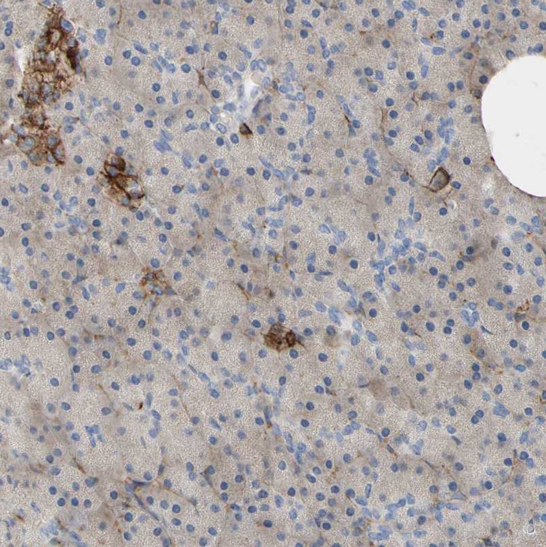 Annexin A6 Antibody - BSA Free Immunohistochemistry: Annexin A6 Antibody - BSA Free [NBP1-90149]