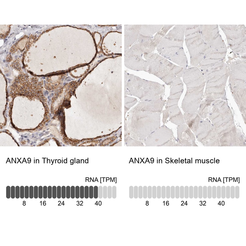 Annexin A9 Antibody - BSA Free Immunohistochemistry: Annexin A9 Antibody - BSA Free [NBP1-90153]