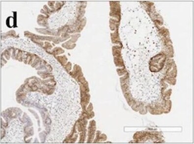 Annexin A10 Antibody