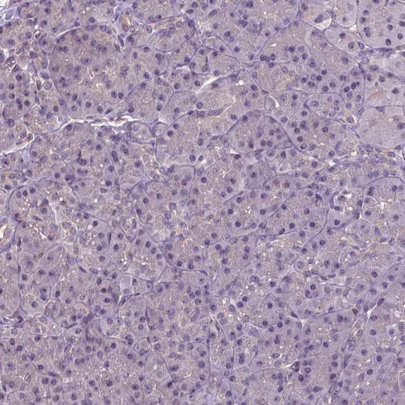 Annexin A13 Antibody - BSA Free Immunohistochemistry: Annexin A13 Antibody - BSA Free [NBP1-90158]