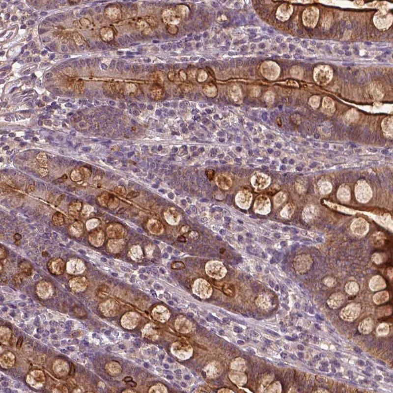 Annexin A13 Antibody - BSA Free Immunohistochemistry: Annexin A13 Antibody - BSA Free [NBP1-90158]