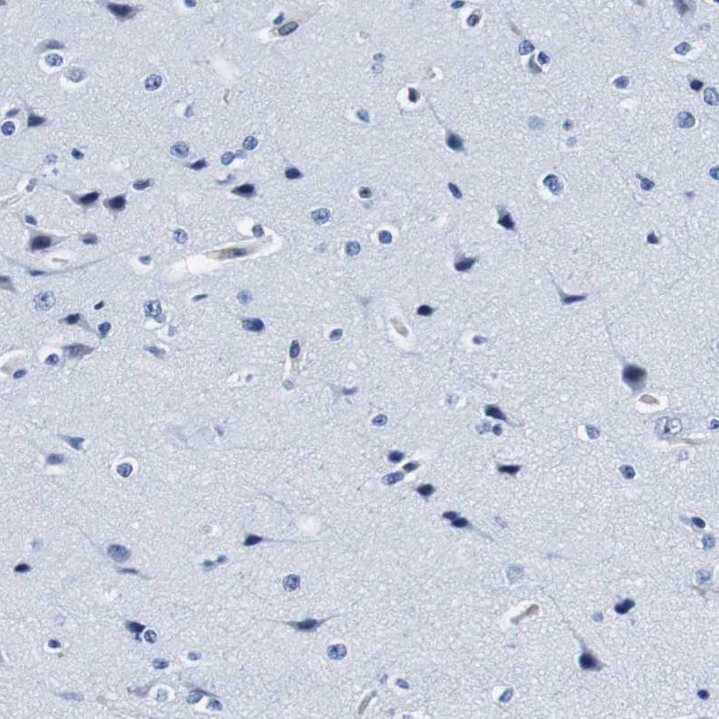 Annexin A1 Antibody - BSA Free Immunohistochemistry: Annexin A1 Antibody - BSA Free [NBP1-90162]