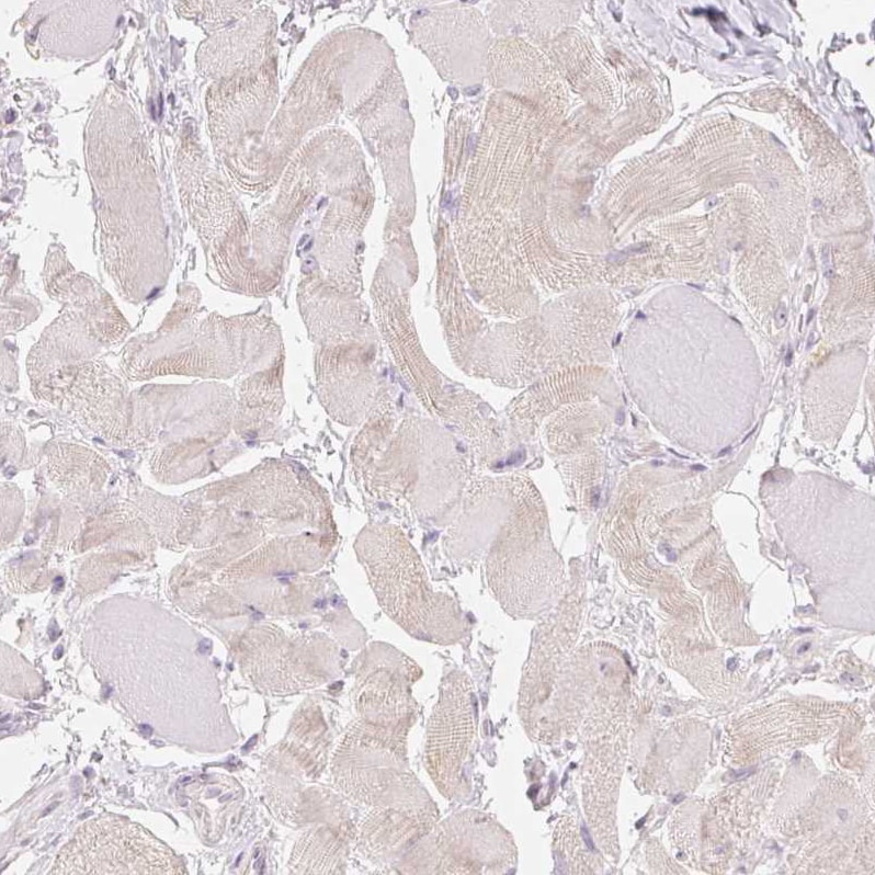 A-Myb Antibody - BSA Free Immunohistochemistry: A-Myb Antibody - BSA Free [NBP1-90171]
