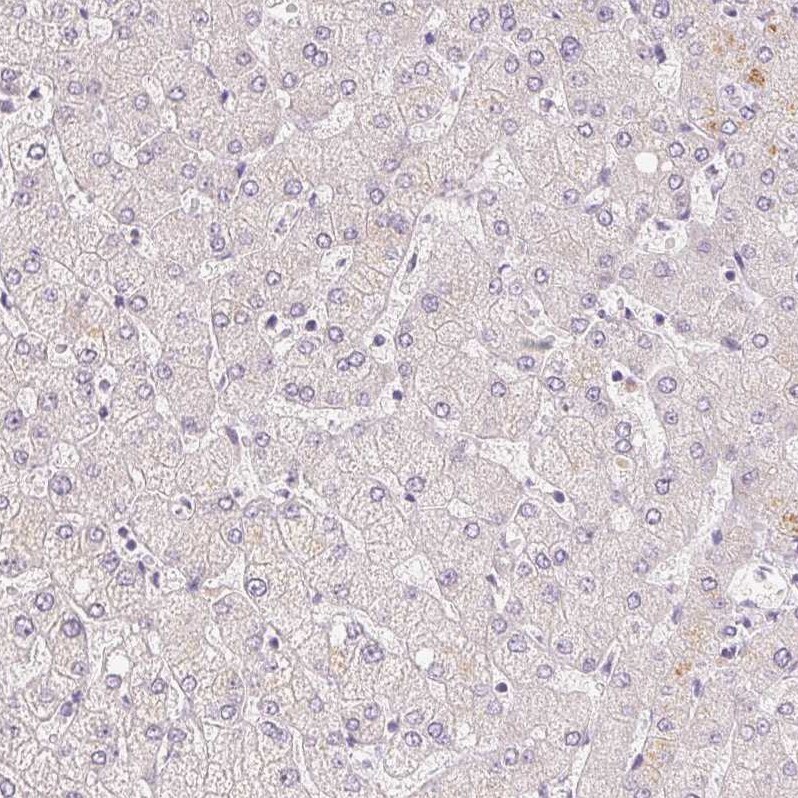 A-Myb Antibody - BSA Free Immunohistochemistry: A-Myb Antibody - BSA Free [NBP1-90171]