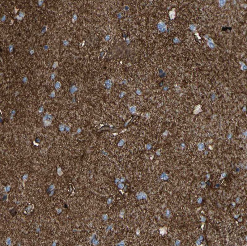 ATPase Na+/K+ beta 2 Antibody - BSA Free Immunohistochemistry: ATPase Na+/K+ beta 2 Antibody - BSA Free [NBP1-90174]