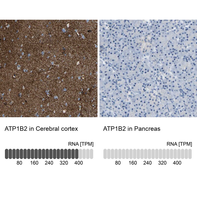 ATPase Na+/K+ beta 2 Antibody - BSA Free Immunohistochemistry: ATPase Na+/K+ beta 2 Antibody - BSA Free [NBP1-90174]