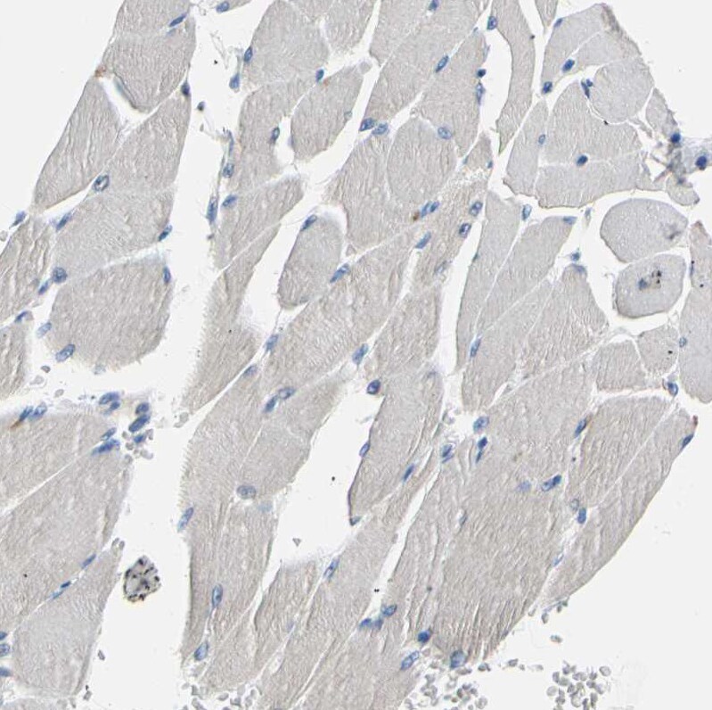 ATPase Na+/K+ beta 2 Antibody - BSA Free Immunohistochemistry: ATPase Na+/K+ beta 2 Antibody - BSA Free [NBP1-90174]