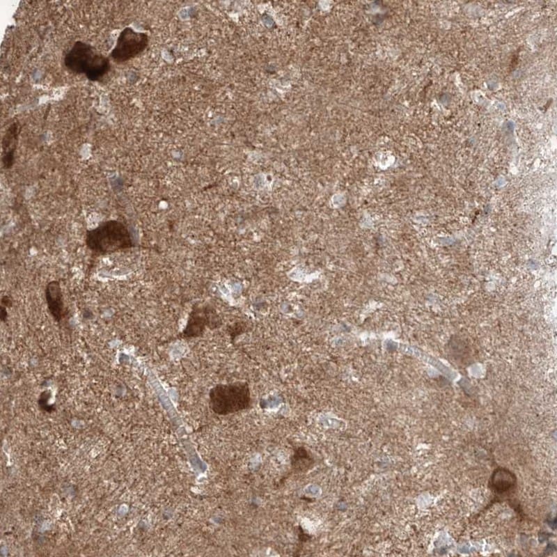 Amisyn Antibody - BSA Free Immunohistochemistry-Paraffin: Amisyn Antibody [NBP1-90175]