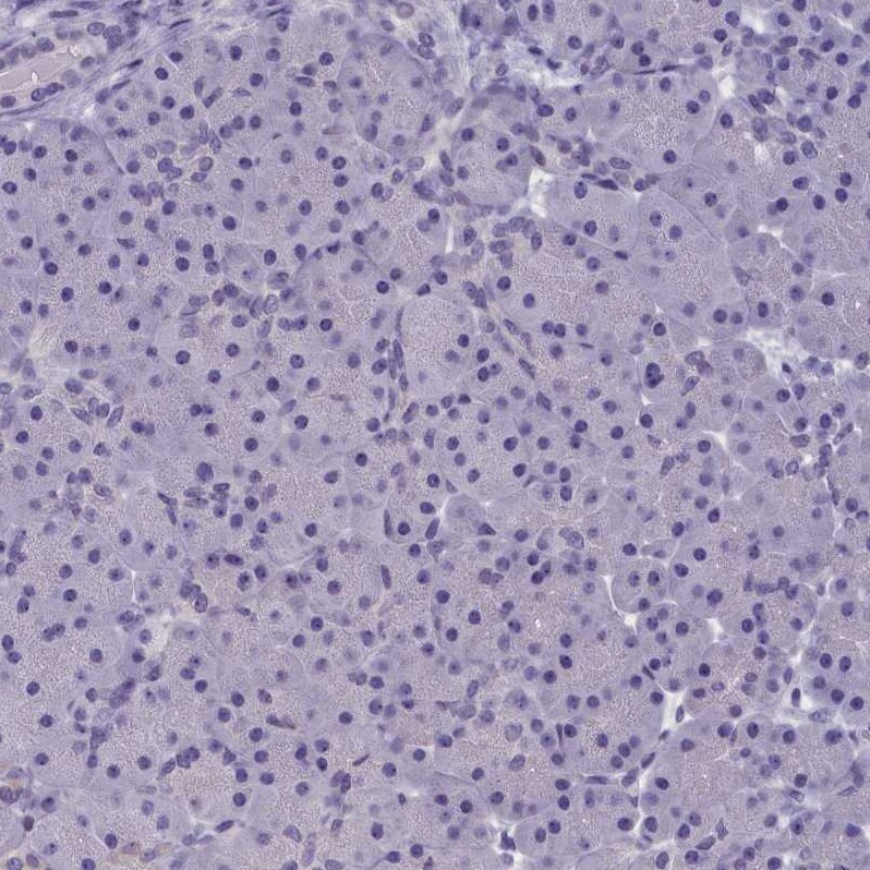 AMID Antibody - BSA Free Immunohistochemistry: AMID Antibody - BSA Free [NBP1-90176]