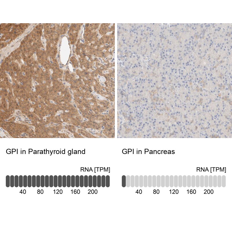 Glucose 6 phosphate isomerase Antibody - BSA Free Immunohistochemistry: Glucose 6 phosphate isomerase Antibody - BSA Free [NBP1-90177]