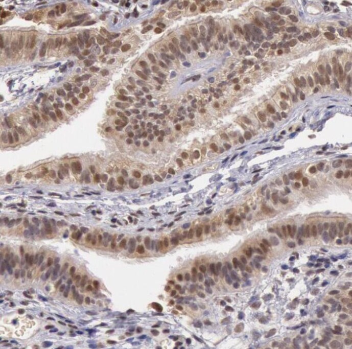 SOD1/Cu-Zn SOD Antibody - BSA Free