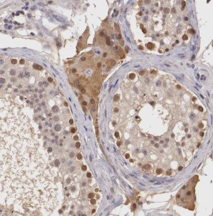 SOD1/Cu-Zn SOD Antibody - BSA Free