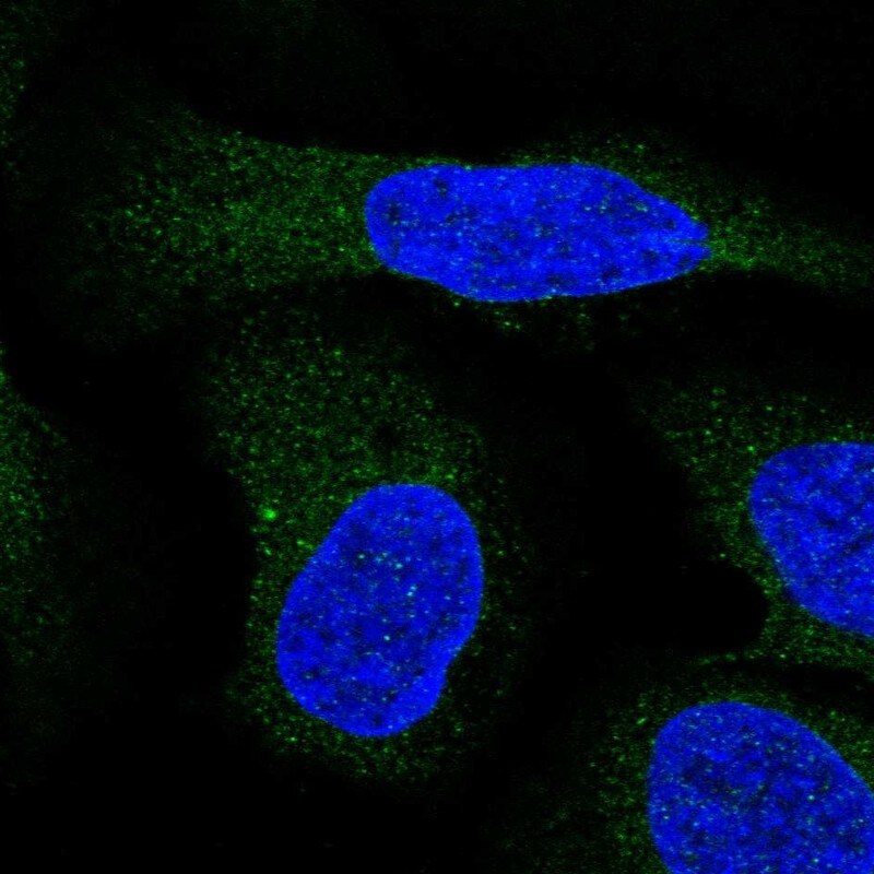 ALG9 Antibody - BSA Free Immunocytochemistry/ Immunofluorescence: ALG9 Antibody [NBP1-90191]