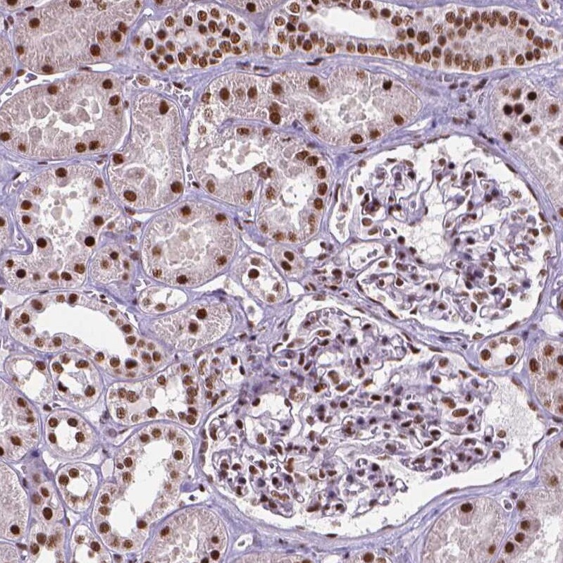 AKAP95/AKAP8 Antibody - BSA Free Immunohistochemistry: AKAP95/AKAP8 Antibody - BSA Free [NBP1-90196]