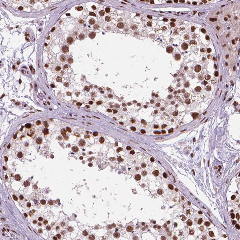 AKAP95/AKAP8 Antibody - BSA Free Immunohistochemistry: AKAP95/AKAP8 Antibody - BSA Free [NBP1-90196]