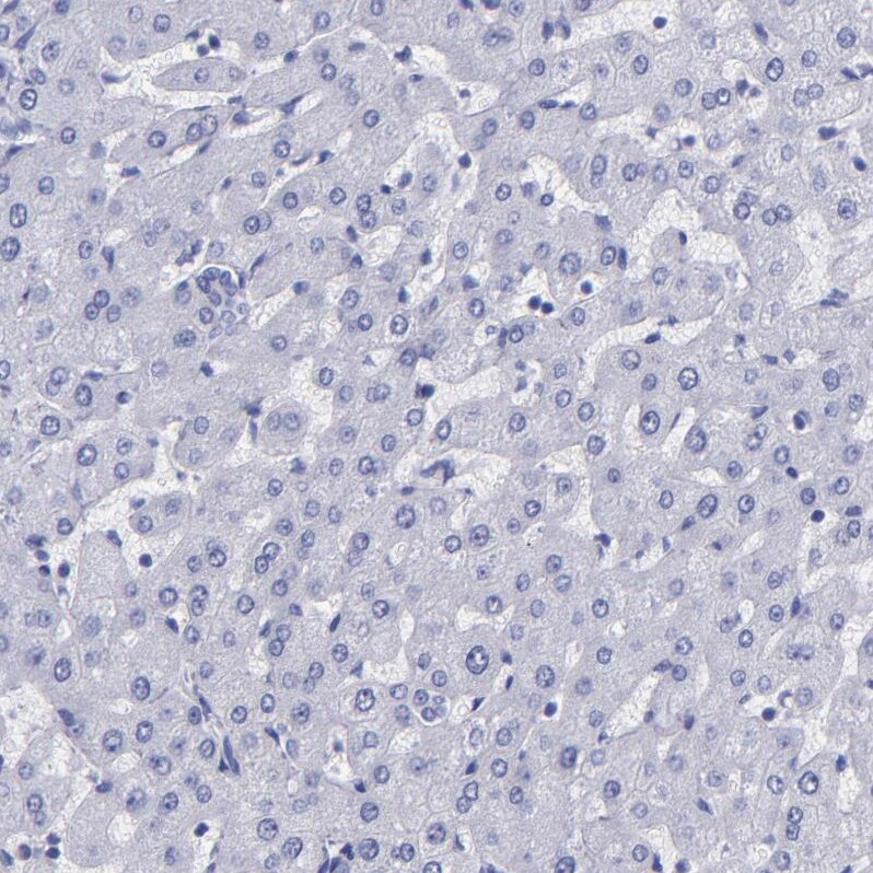 Thyroglobulin Antibody - BSA Free Immunohistochemistry: Thyroglobulin Antibody - BSA Free [NBP1-90200]