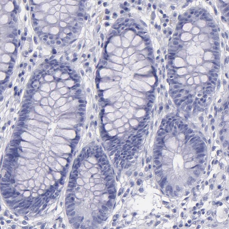 Thyroglobulin Antibody - BSA Free Immunohistochemistry: Thyroglobulin Antibody - BSA Free [NBP1-90200]